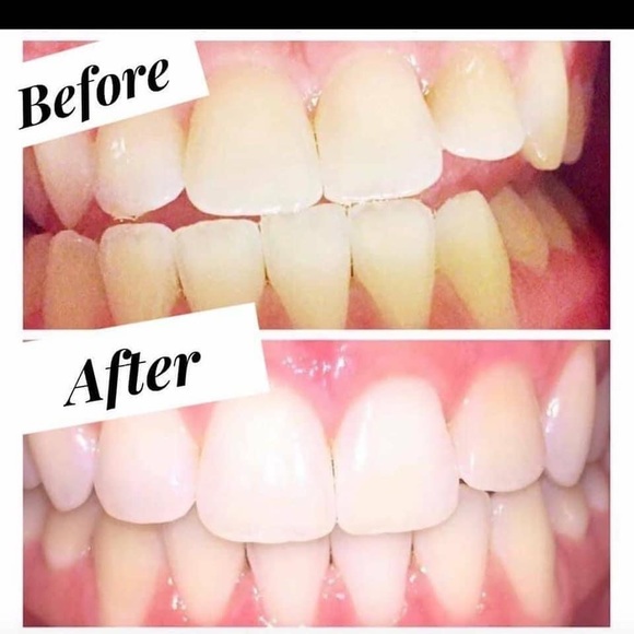 Whitening paste! - Picture 2 of 8